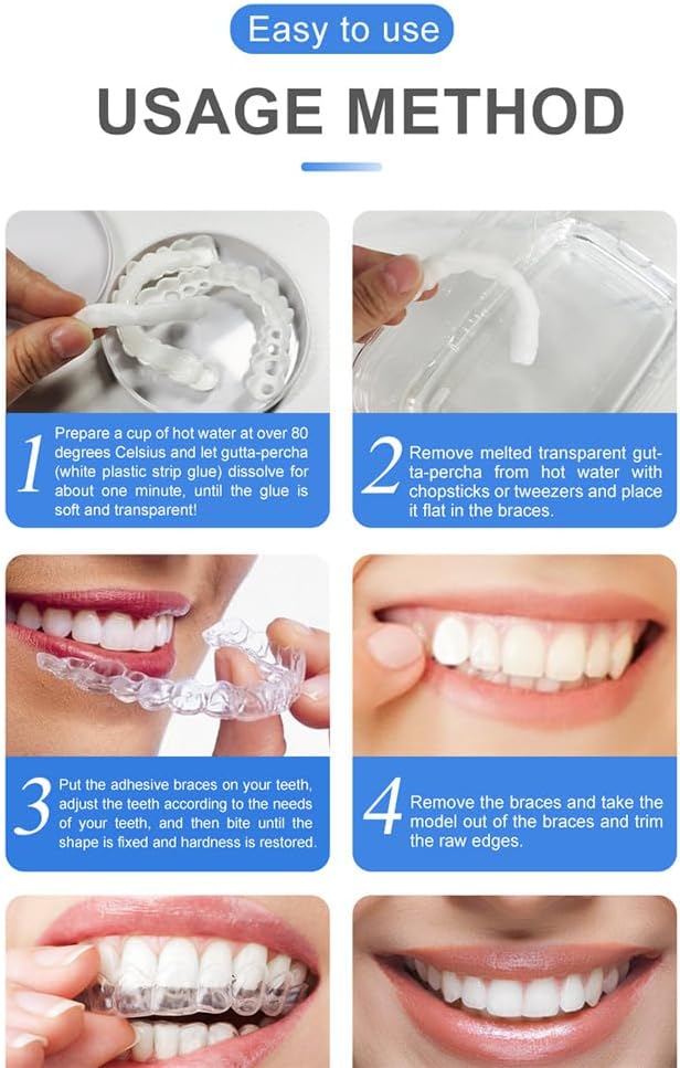 Snap On Smile Braces Teeth Kit For Men & Women