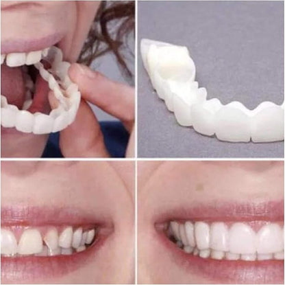 Snap On Smile Braces Teeth Kit For Men & Women